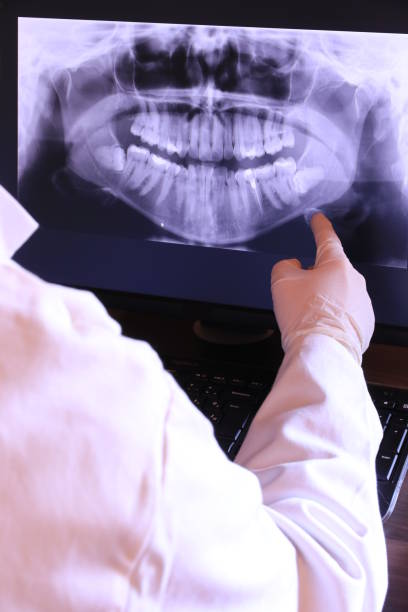 Best Chipped Tooth Repair Near Me  in Rogersville, AL